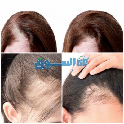 زيت لحماية الشعر من تساقط وتقويته
